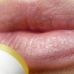 Labbra screpolate come risolvere in modo semplice