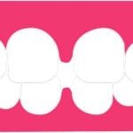 Gengive gonfie ecco come curarle in modo naturale