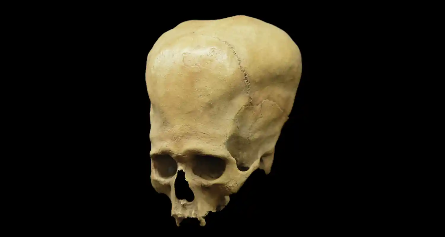 I teschi allungati ritrovati in Peru non sono Homo Sapiens