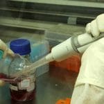 Immunoterapia utile per il melanoma avanzato