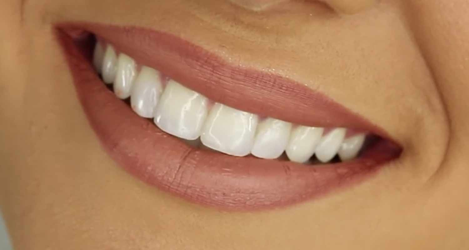 фото красивых зубов у женщин