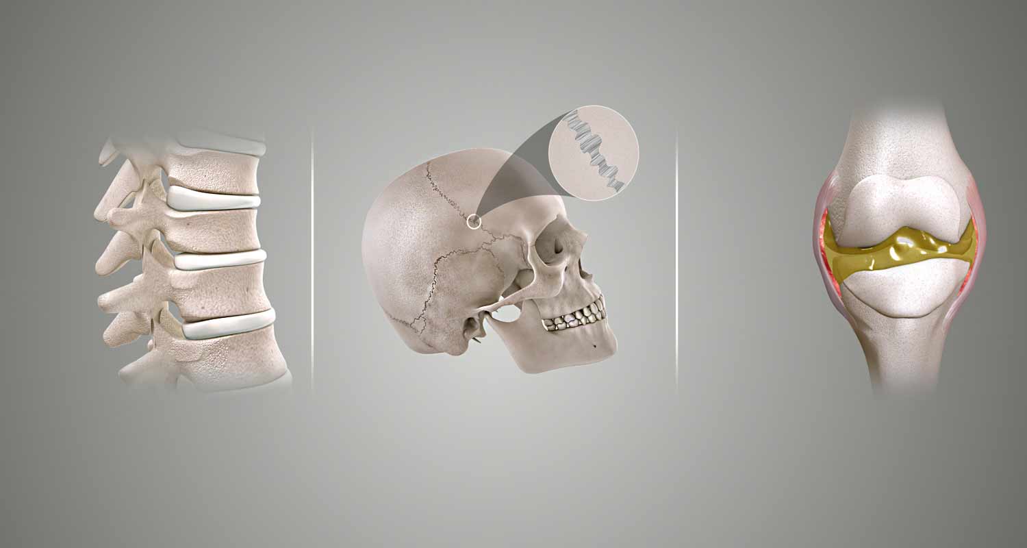 Rigidita articolare come prevenirla e combatterla