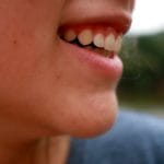 Ecco una cura naturale per acne