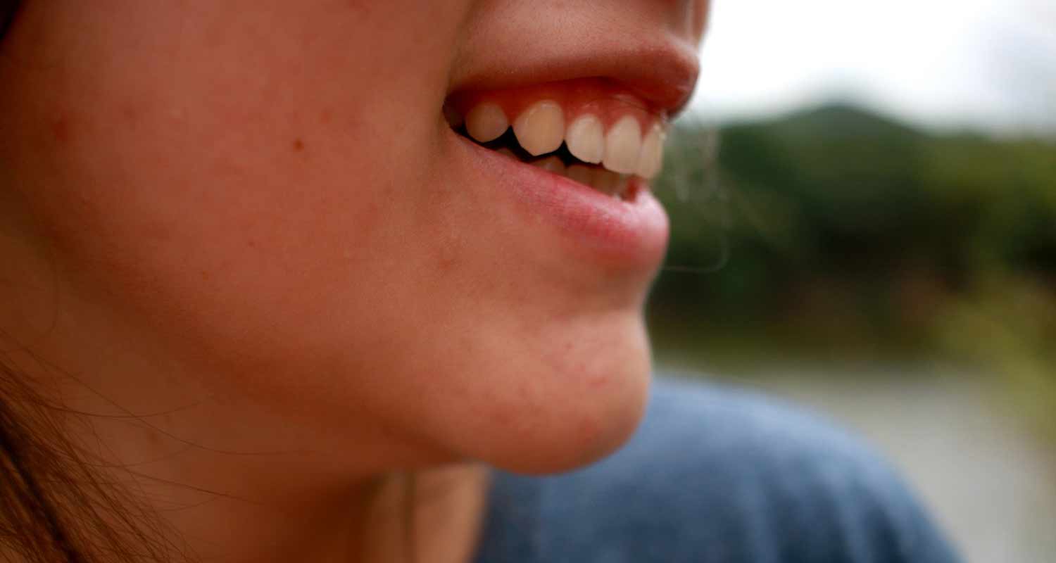 Ecco una cura naturale per acne