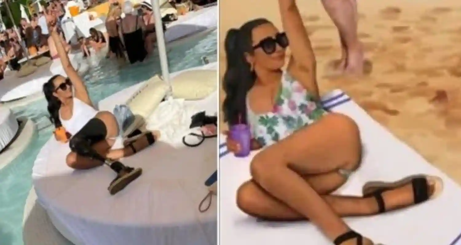 La protesi della modella viene coperta scoppiano le polemiche