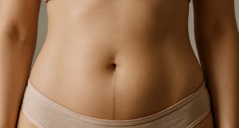 Linea nigra perché compare quella linea scura sulla pancia