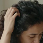 rimedi-naturali-forfora-guida-completa-biologia-cute