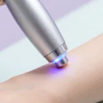guida-depilazione-laser-professionale-vantaggi-tecnologia